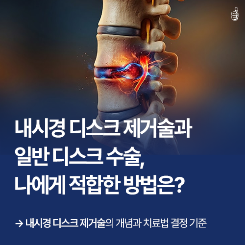 B261026_의정부+서울척병원_내시경디스크제거술_1.png