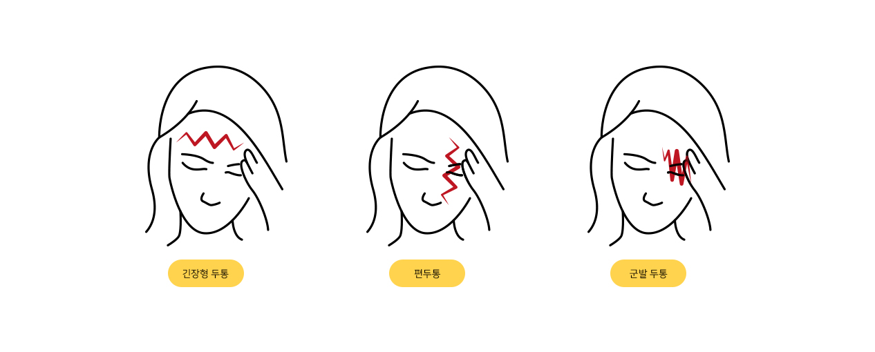 서울척병원 뇌신경센터 두통